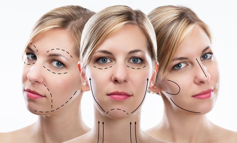 optimum-mobility-facelift-vs-deep-plane-facelift