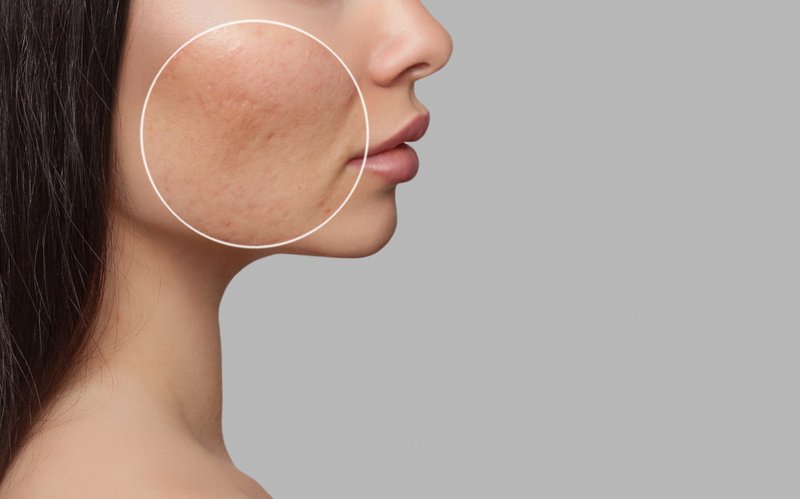 young-woman-with-facial-scar
