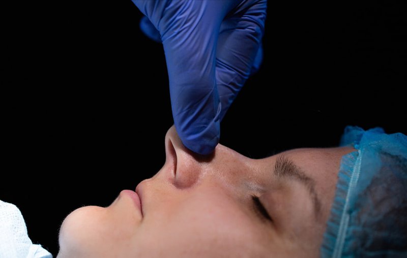 nasal-correction