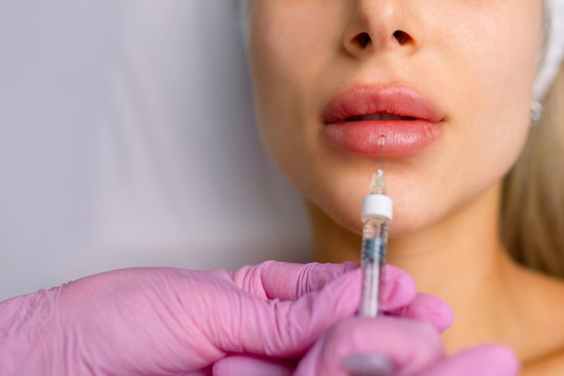 young-woman-undergoing-lip-filler-procedure