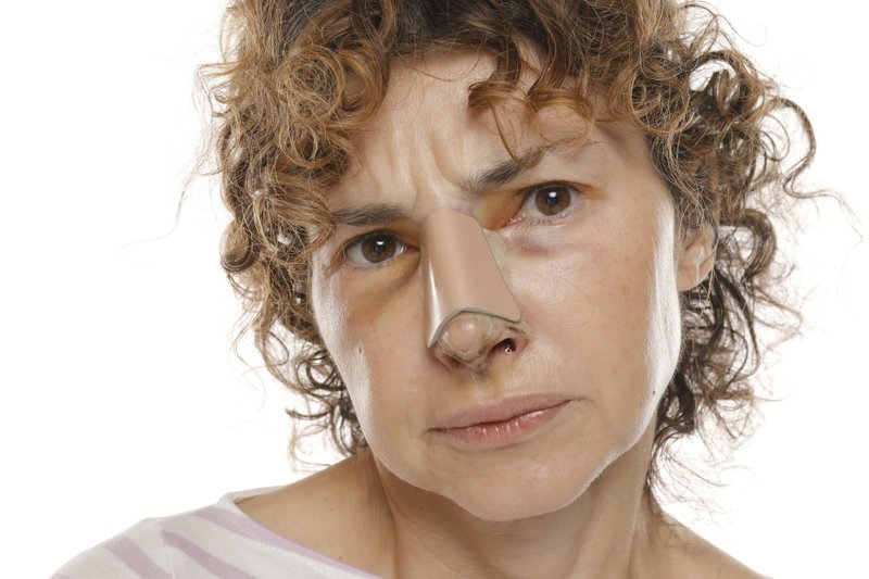 middle-aged-woman-with-bandage-on-nose-after-rhinoplasty