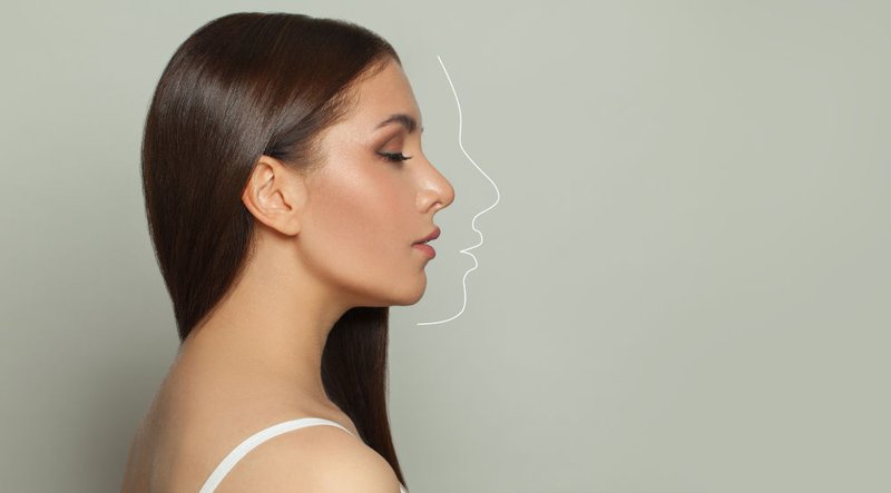 Bulbous Nose Rhinoplasty