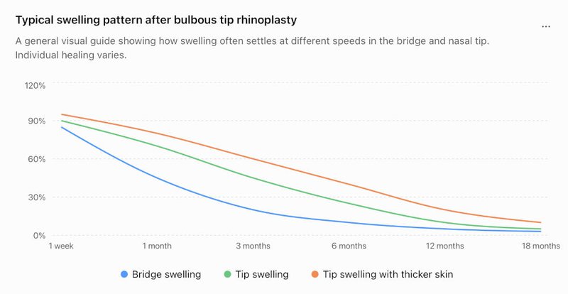 Swelling pattern chart