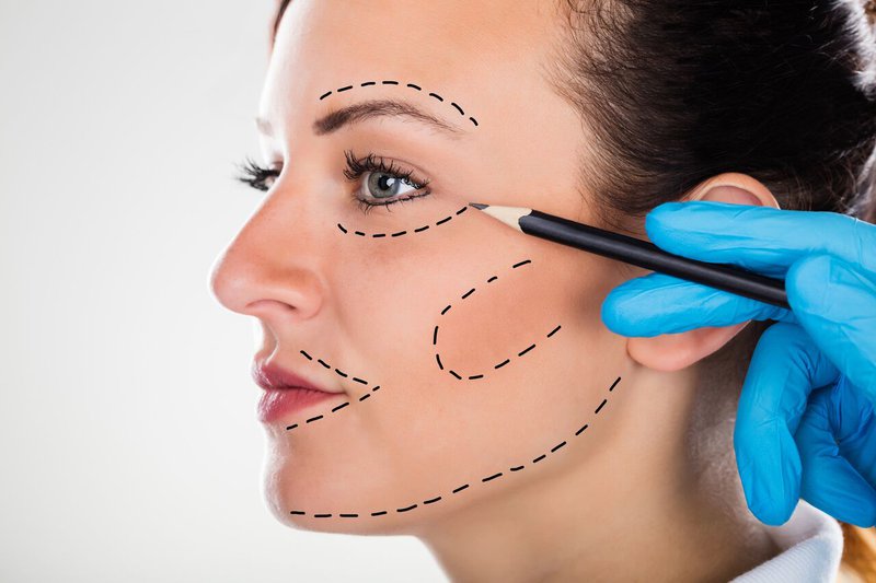 When Is the Ideal Time to Undergo Facelift Surgery.jpeg